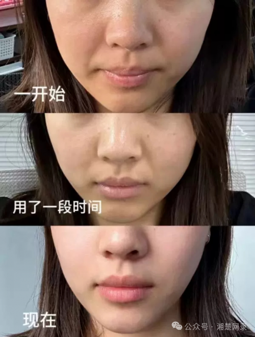 護(hù)膚品補(bǔ)水好評(píng)語(yǔ)30字_護(hù)膚品補(bǔ)水好還是緊致好_補(bǔ)水好的護(hù)膚品